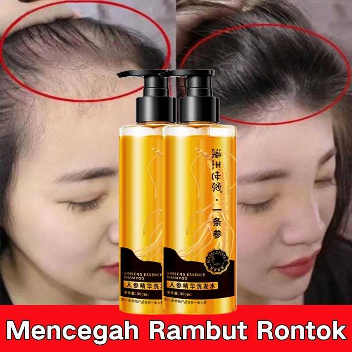 Natur Shampoo Ginseng 300ml Shampo Penumbuh Rambut Cepat pertumbuhan rambut Pengendalian Minyak Anti