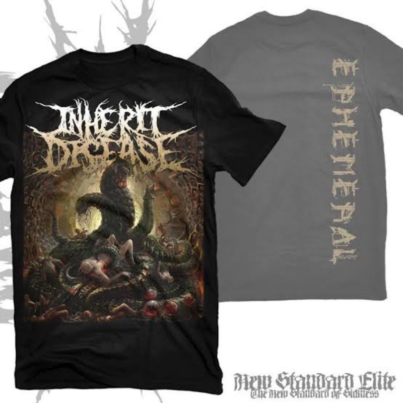 ts inherit disease -  ephemeral