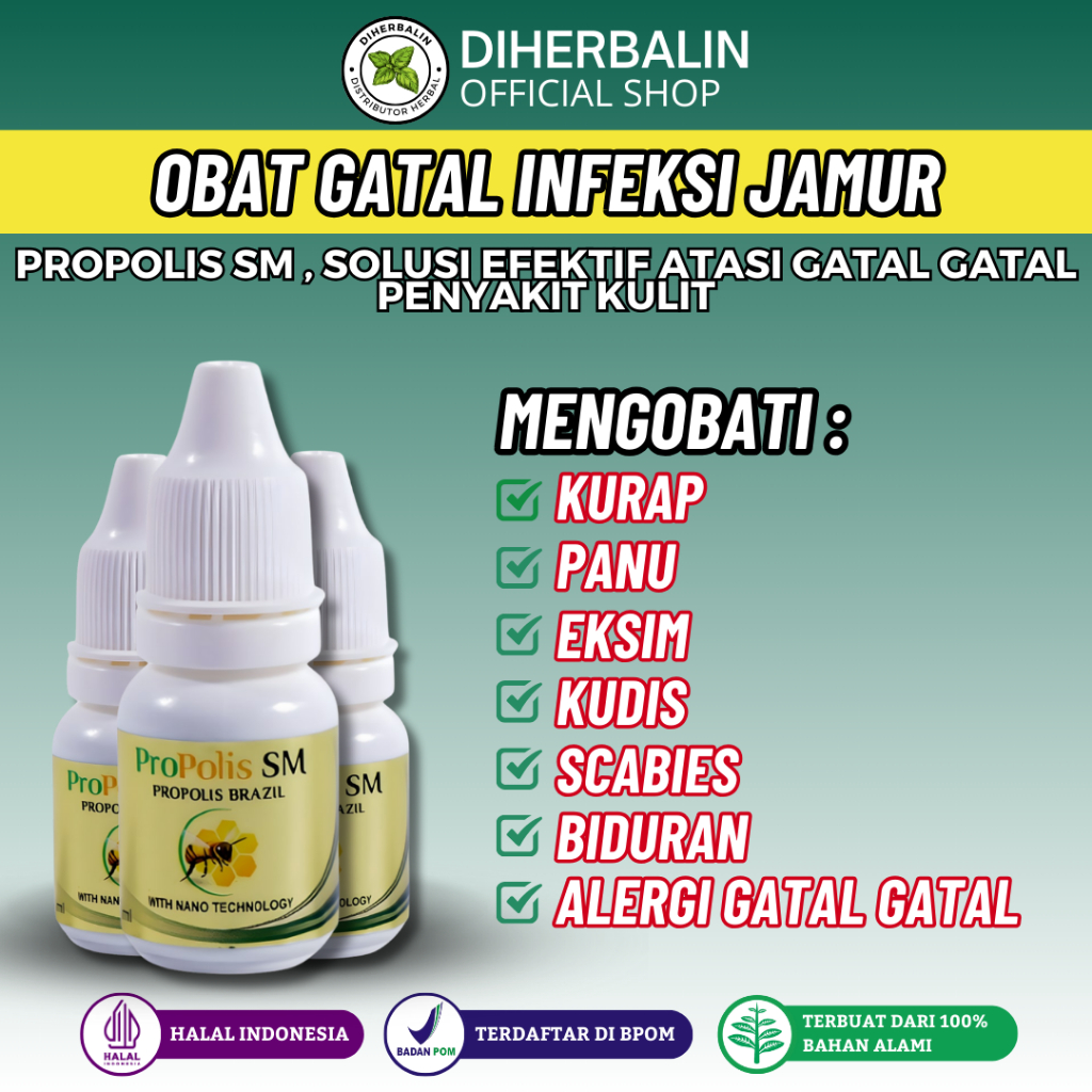 Obat Herpes Zoster, Obat Cacar Air, Salep Cacar Air, Obat Penghilang Cacar Air & Bekas Cacar bayi /