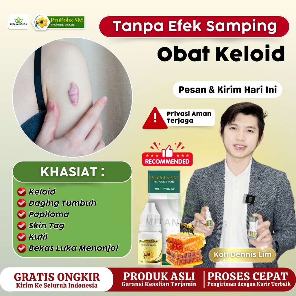 Obat Keloid / Obat Keloid Daging Tumbuh / Obat Keloid Menahun / Obat Penghilang Keloid / Obat Keloid
