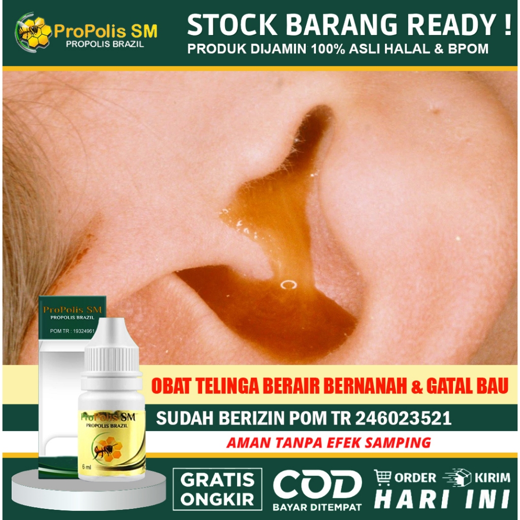 Obat Telinga Congek Bernanah Gatal Berair dan Bau Busuk Propolis SM Untuk Telinga