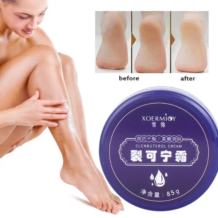 RB AMPUH Cream Kaki Pecah Dan Kering 85g Tumit Ampuh Mengatasi Kaki Pecah Kapalan Kasar Kering