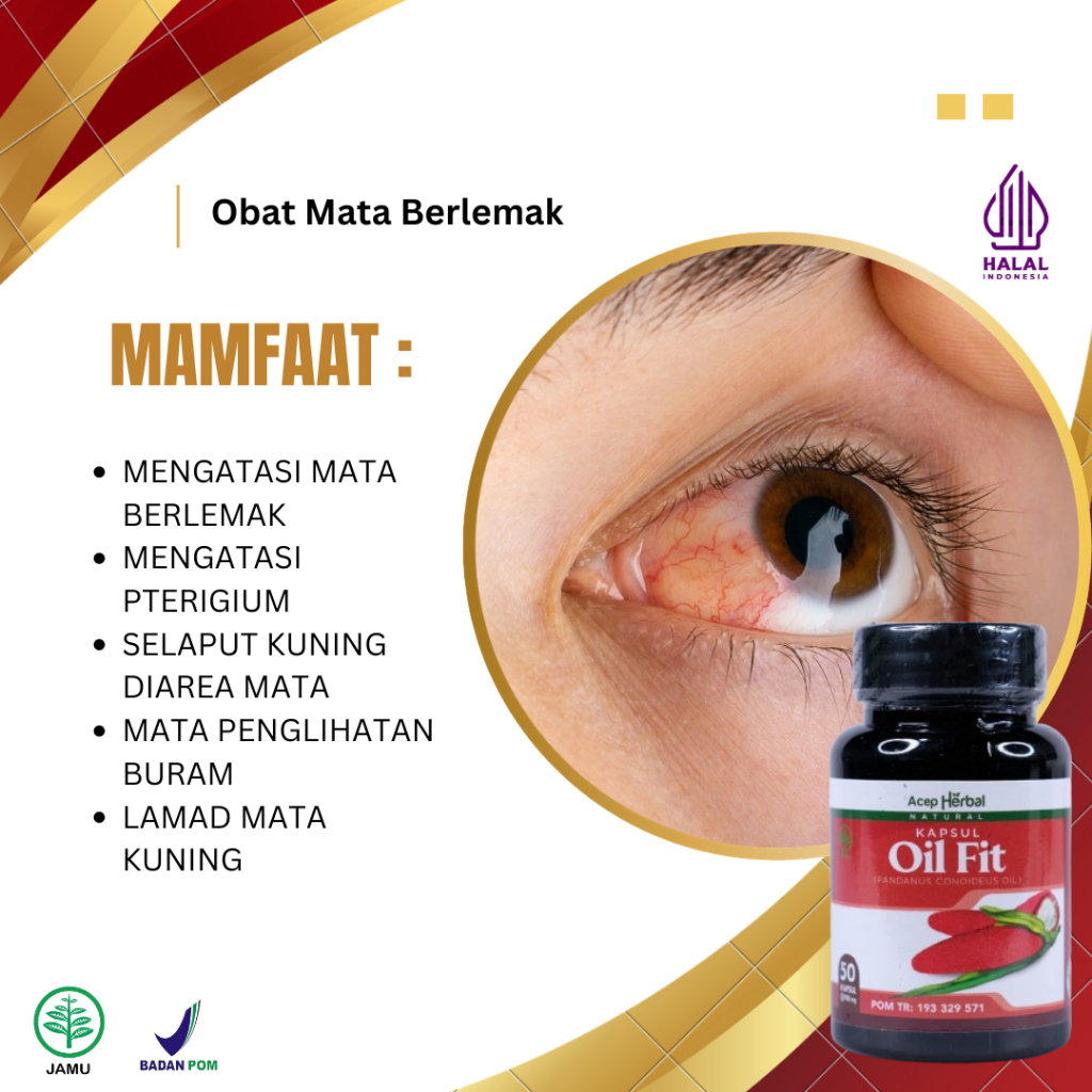 Obat Mata Berlemak, Obat Pembersih Pterigium, Obat Penghilang Pterigium, Obat Selaput Mata Kuning, O