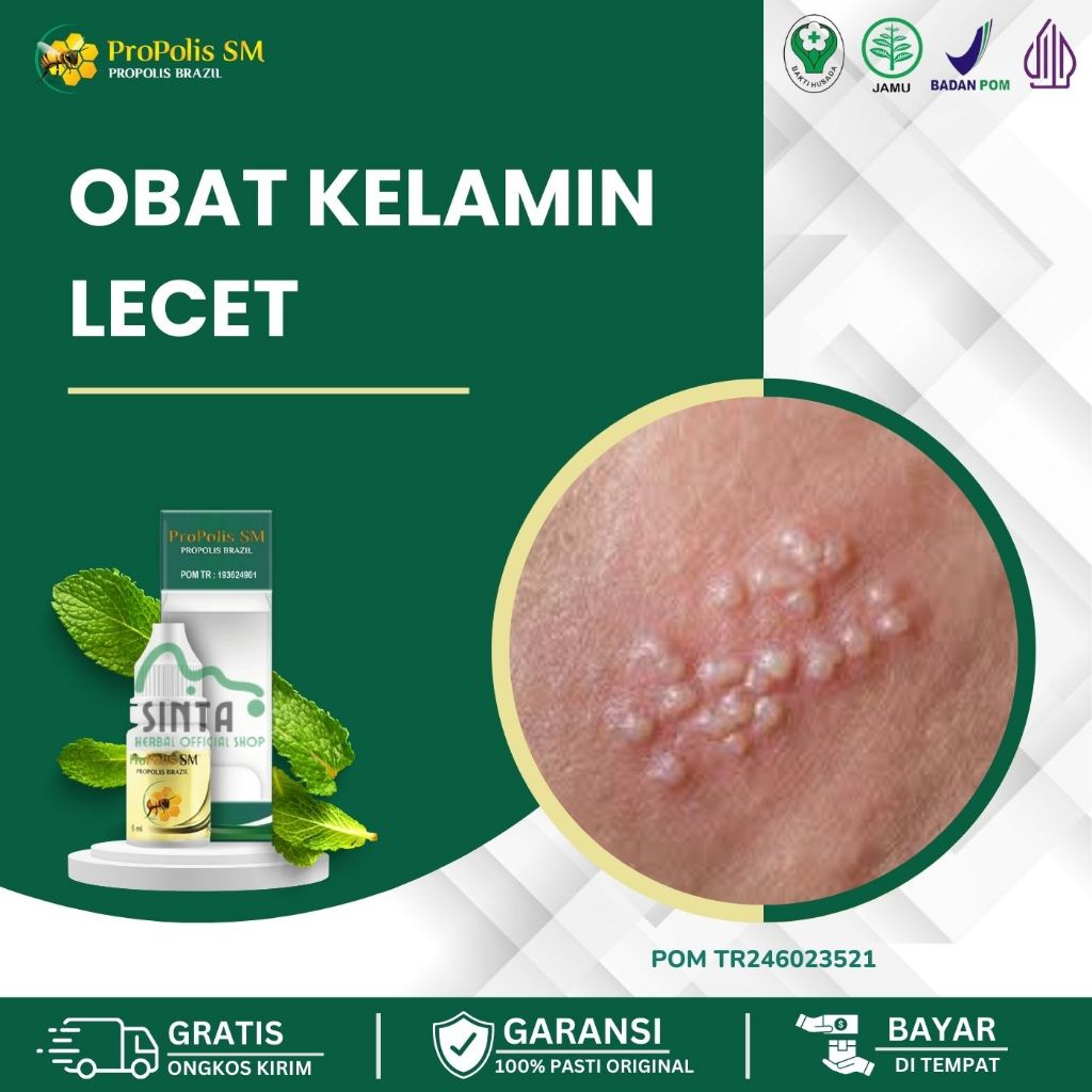 Obat Luka Pada Kelamin Pria, Luka Batang Kelamin Pria, Penis Lecet, Luka Kelamin Pria, Gesekan, Kuli