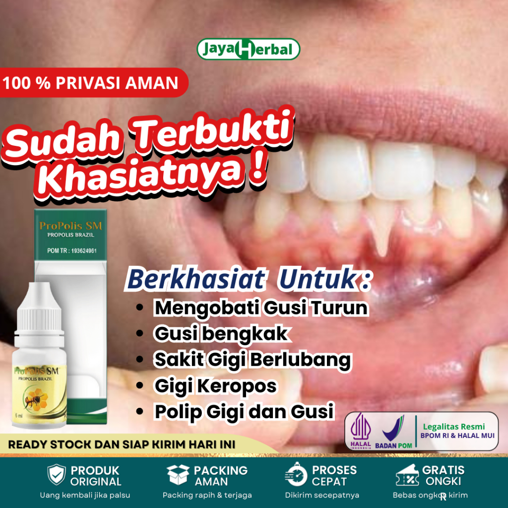 Obat Gusi Turun, Obat Herbal Tetes Untuk Mengatasi Resesi Gusi, Gigi Berlubang Nyutnyutan, Obat Gigi