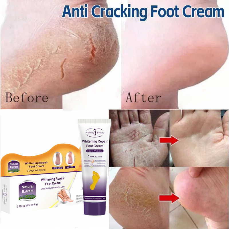 Foot cream obat kaki pecah Krim perawatan kaki Penghilang Kaki Pecah Dan Kering krim kaki pecah dan 