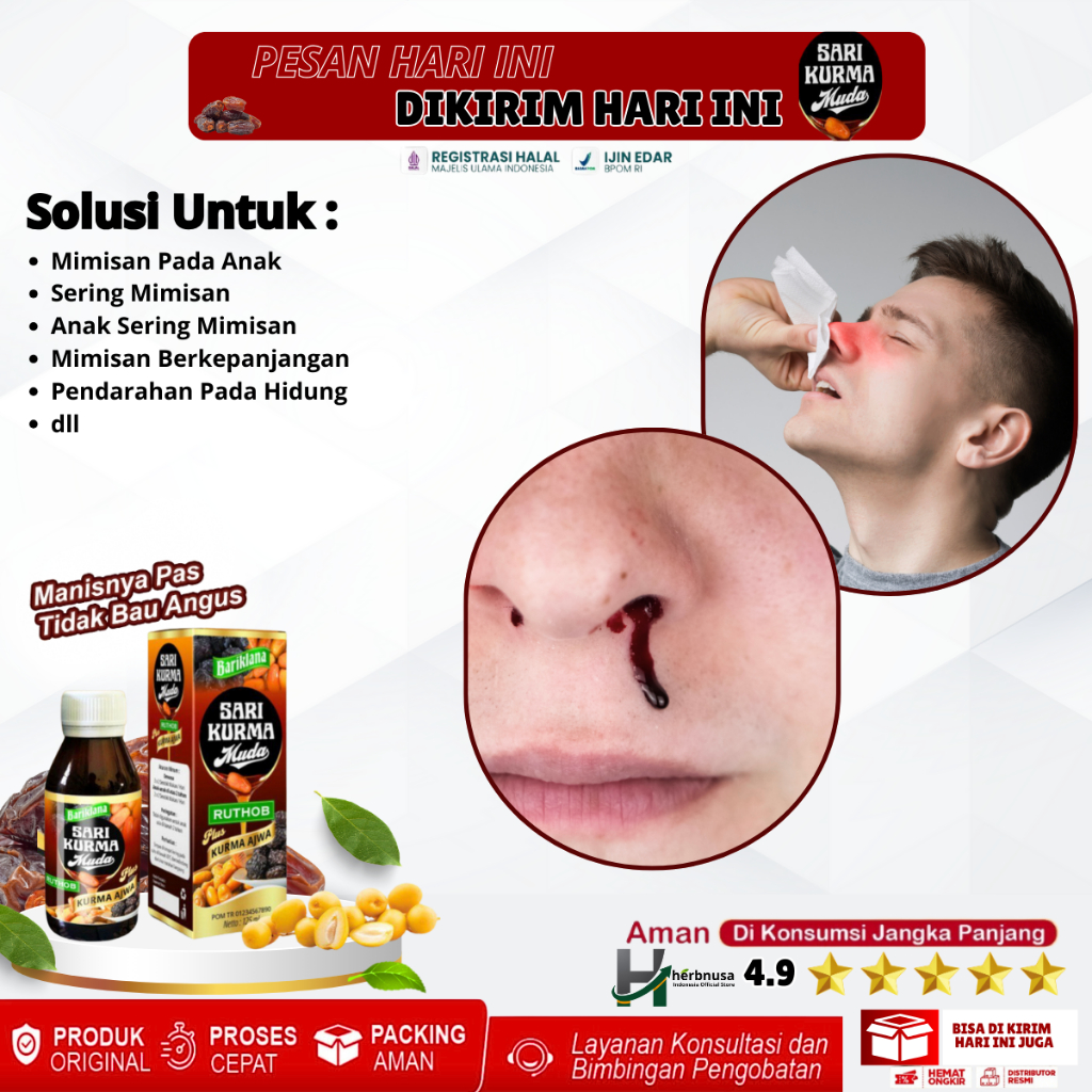 Obat Mimisan Pada Anak, Obat Sering Mimisan, Obat Anak Sering Mimisan, Mimisan Berkepanjangan, Penda