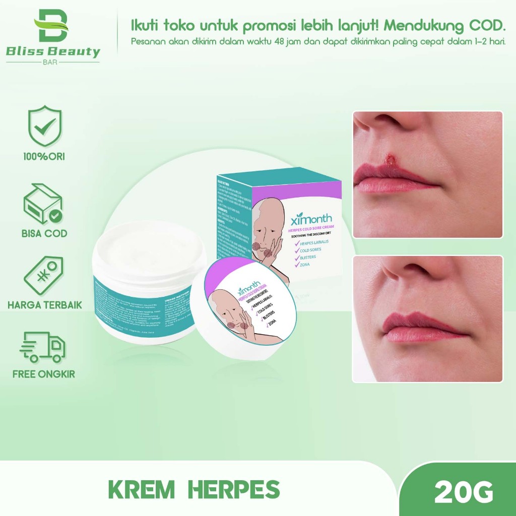 Ximonth Herpes Cold Sore Cream 20g Cheilitis Cream Bibir Peradangan Bibir Herpes Bibir Kering