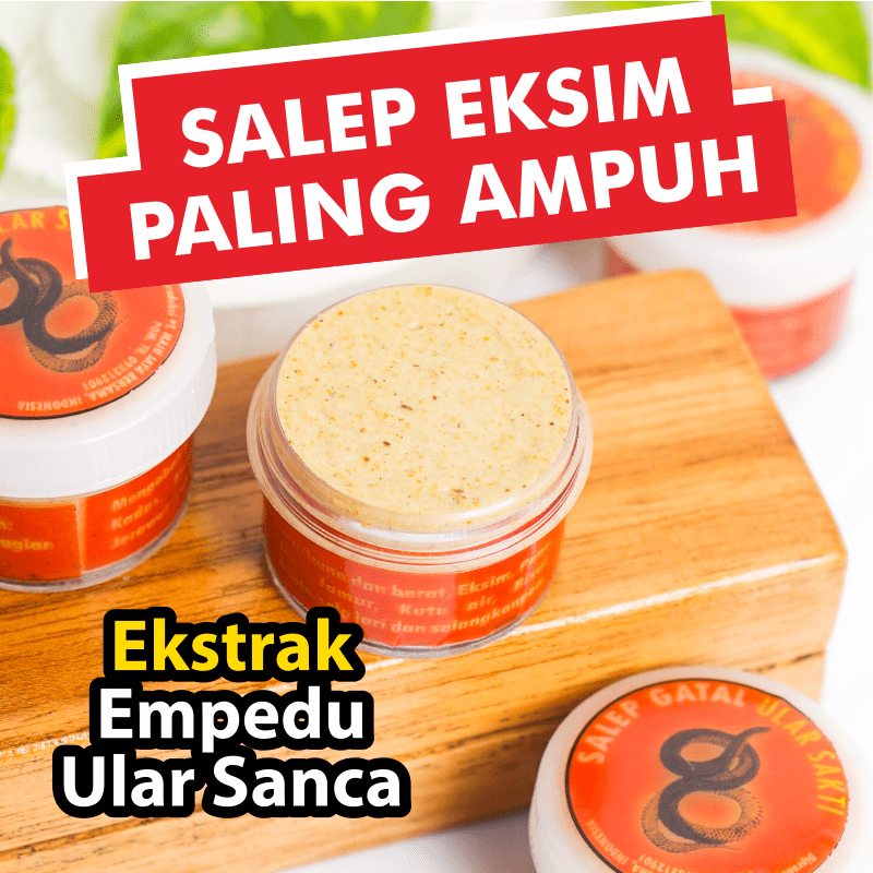 Salep Obat Gatal Kulit Eksim Kering Paling Ampuh Gatel Exim Salap Gatal Kurap Panu Kutu Air Psoriasi