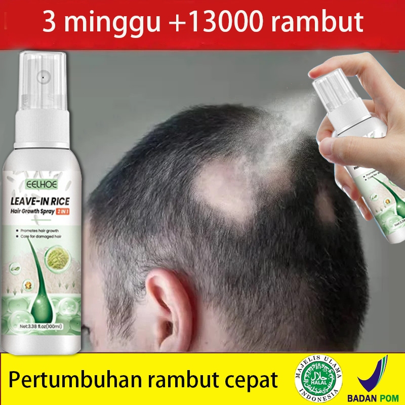 penumbuh rambut botak Serum Penumbuh Rambut untuk Rambut Botak dan Rontok - 100ml botak serum rambut