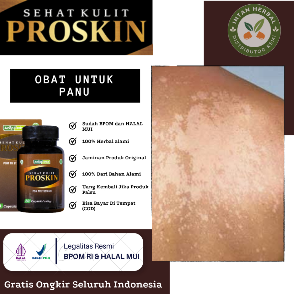 Proskin Kapsul - Obat Untuk Panu, Kurap, Panu di Wajah, Hapur, Panu di Badan, Jamur Kulit, Gatal Kur