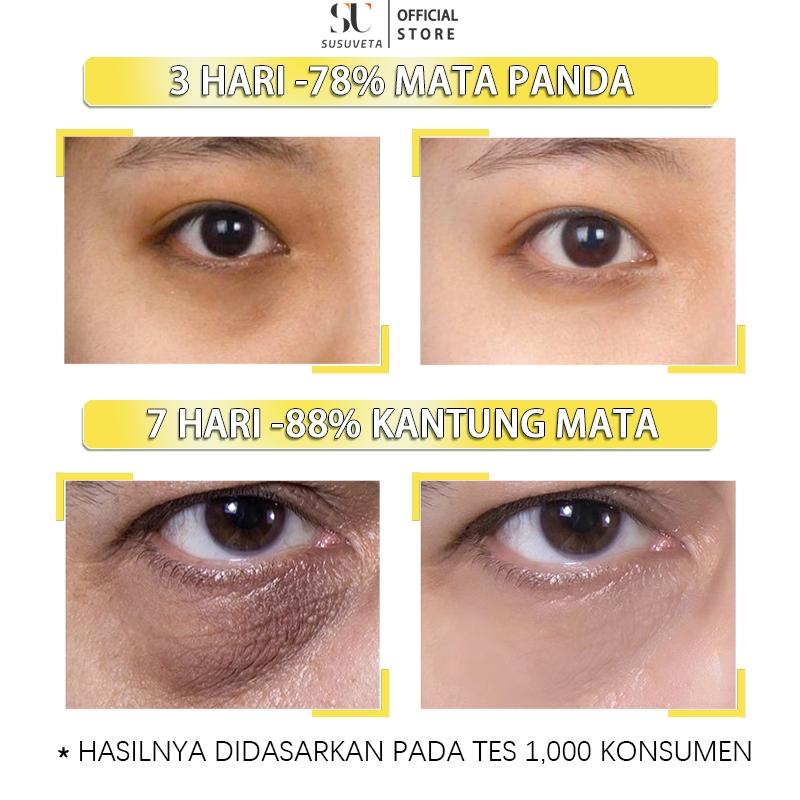 SHVA. Eye cream kantung mata penghilang kantung mata panda dan kantung mata ampuh penghilang mata