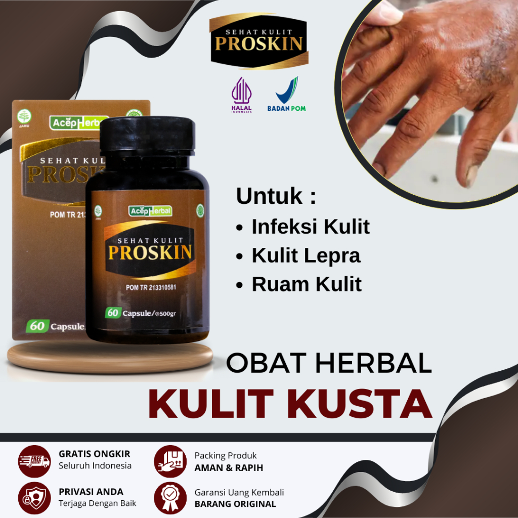 Obat Kusta, Obat Lepra, Obat Kusta Basah, Obat Kusta Kering, Obat Penyakit Kulit, Obat Kulit Bercak 