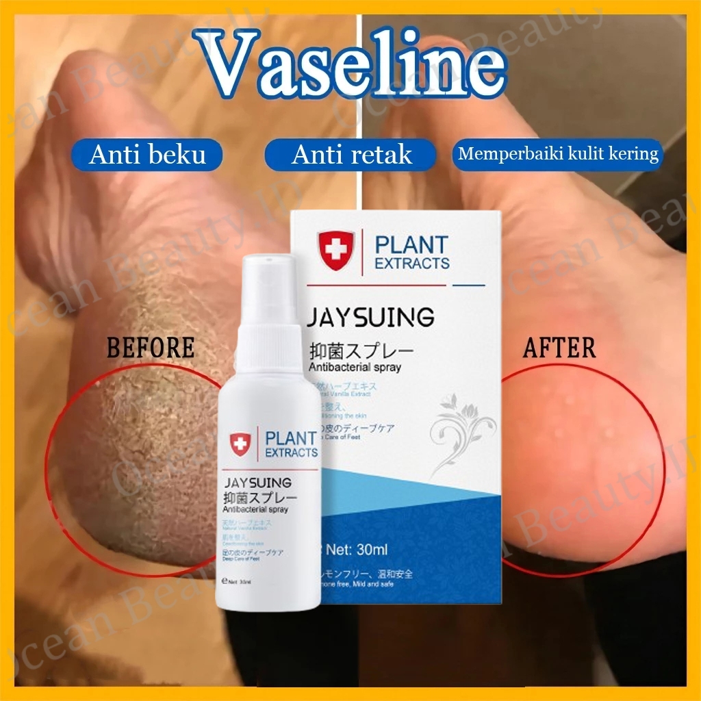 kaki pecah dan kering Foot semprotan Obat kaki pecah Pelembab kaki kering dan pecah Penghalus kaki k