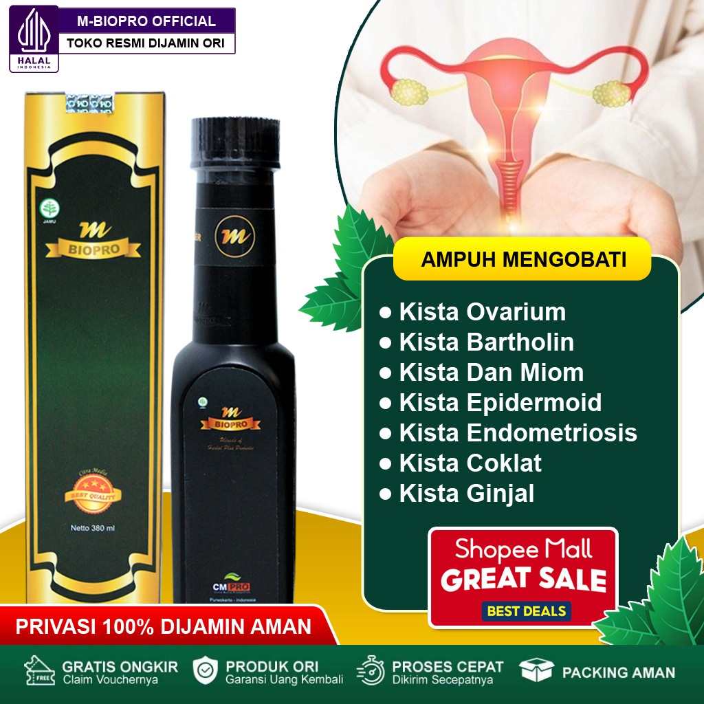 Obat Kista Ovarium, Kista Bartholin, Kista Epidermoid, Kista Endometriosis, Kista Coklat, Kista Bake