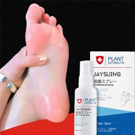 kaki pecah dan kering Foot semprotan Obat kaki pecah Pelembab kaki kering dan pecah Penghalus kaki k