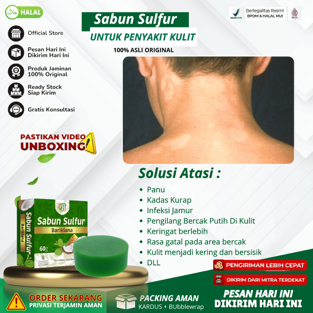 Sabun Sulfur - Sabun Binahong Obat Panu, Penghilang Panu, Obat Panu Anak, Obat Hapur Kulit, Penghila