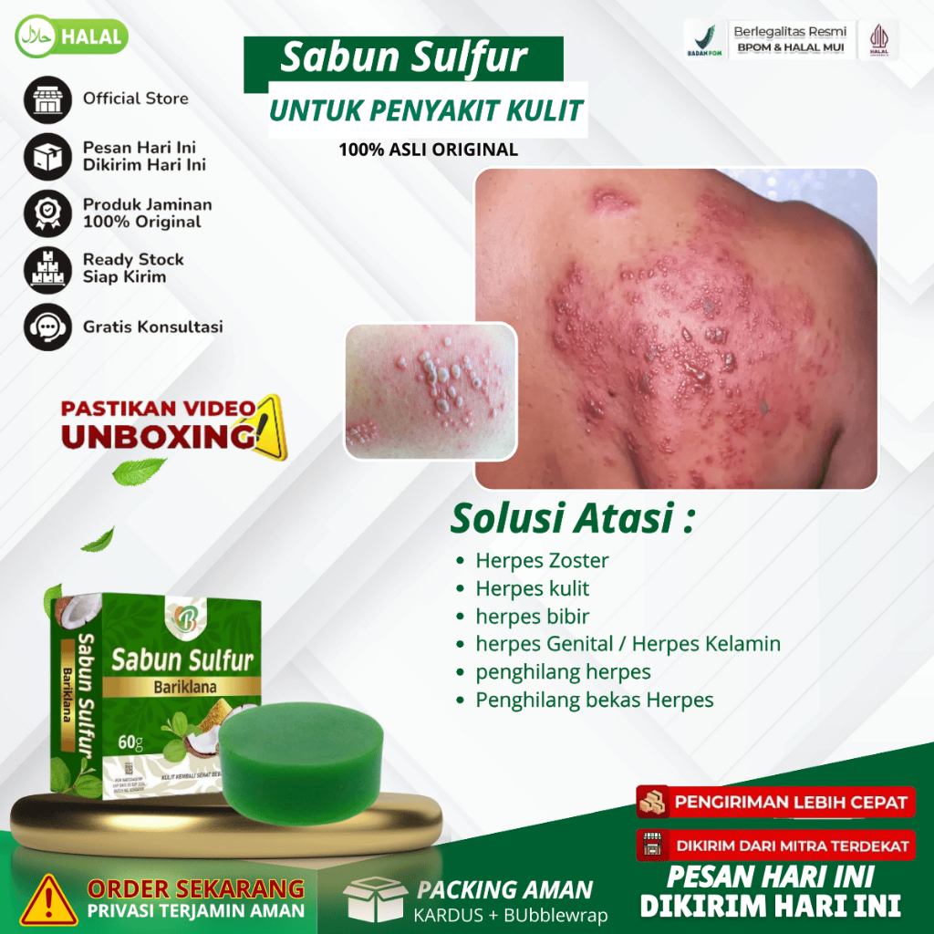 Sabun Sulfur - Sabun Binahong Obat Herpes Zoster, Obat Herpes kulit, Obat herpes bibir, Obat herpes 