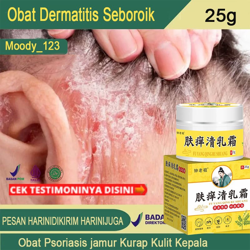 Obat Dermatitis Seboroik 25g Salep gatal paling ampuh Obat psoriasis Penghilang Kulit Merah Obat Bor