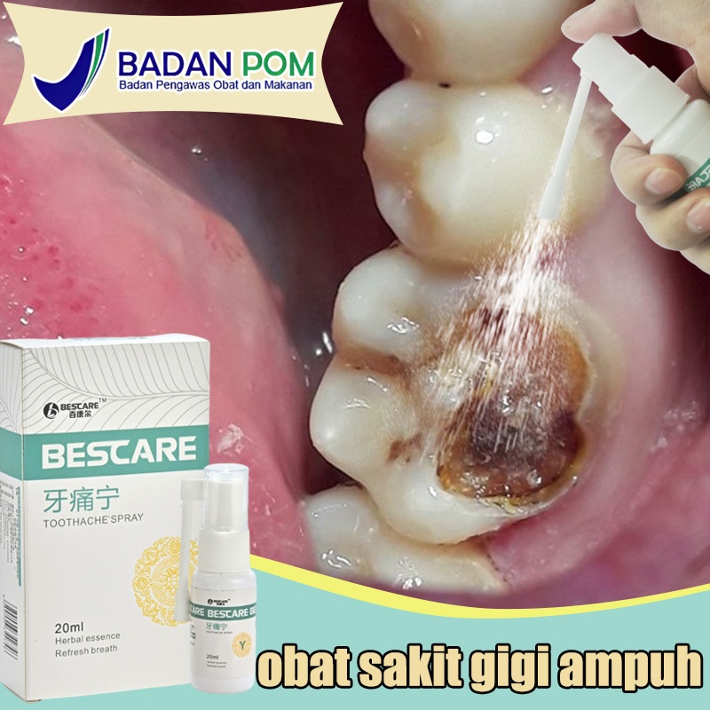Obat sakit gigi berlubang Obat sakit gigi ampuh Obat sakit gigi semprot Obat sakit gigi anak 20ml sa