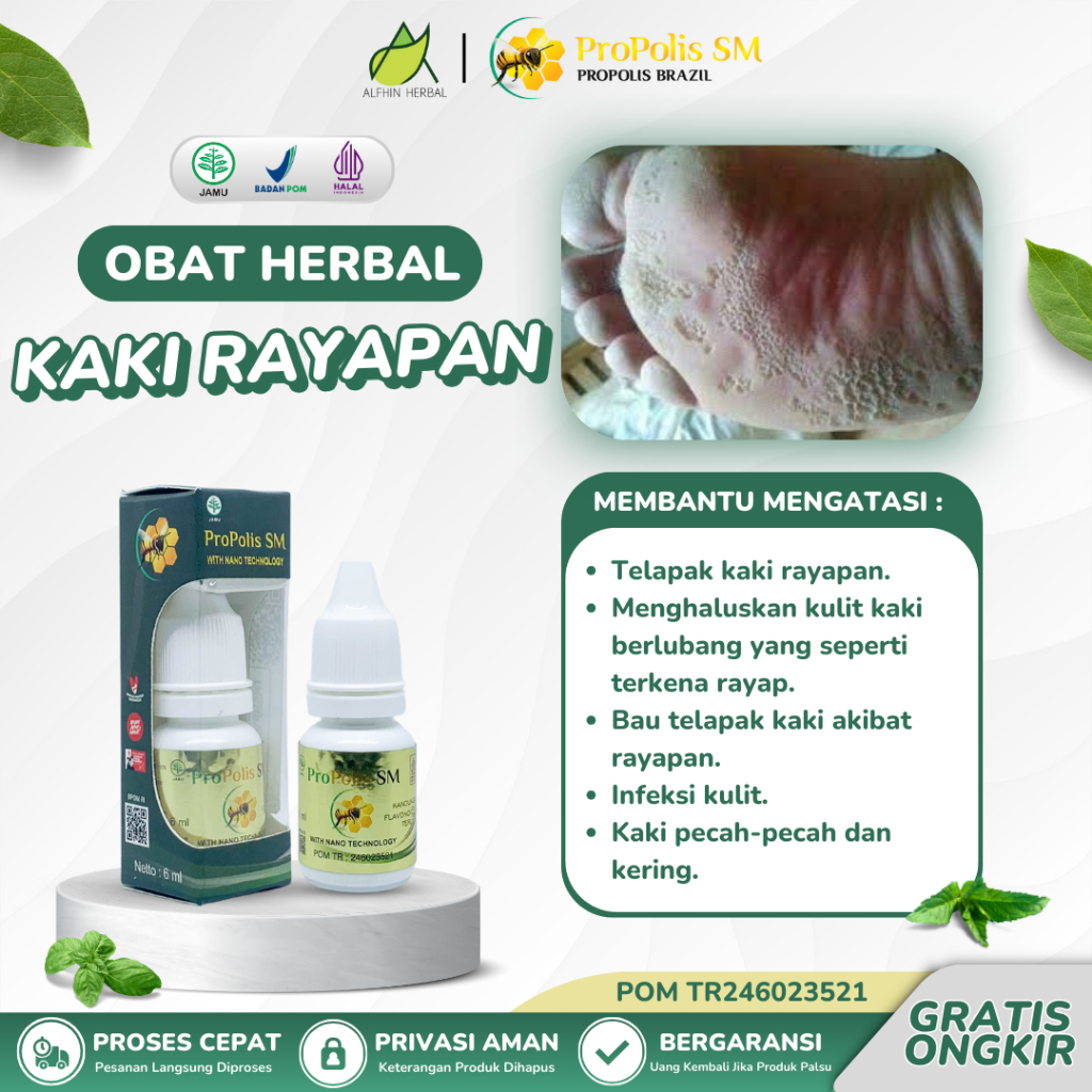 Obat Telapak Kaki Rayapan Propolis SM, Mengatasi Telapak Kaki Bolong, Berlubang Lubang Dan Bau, Obat