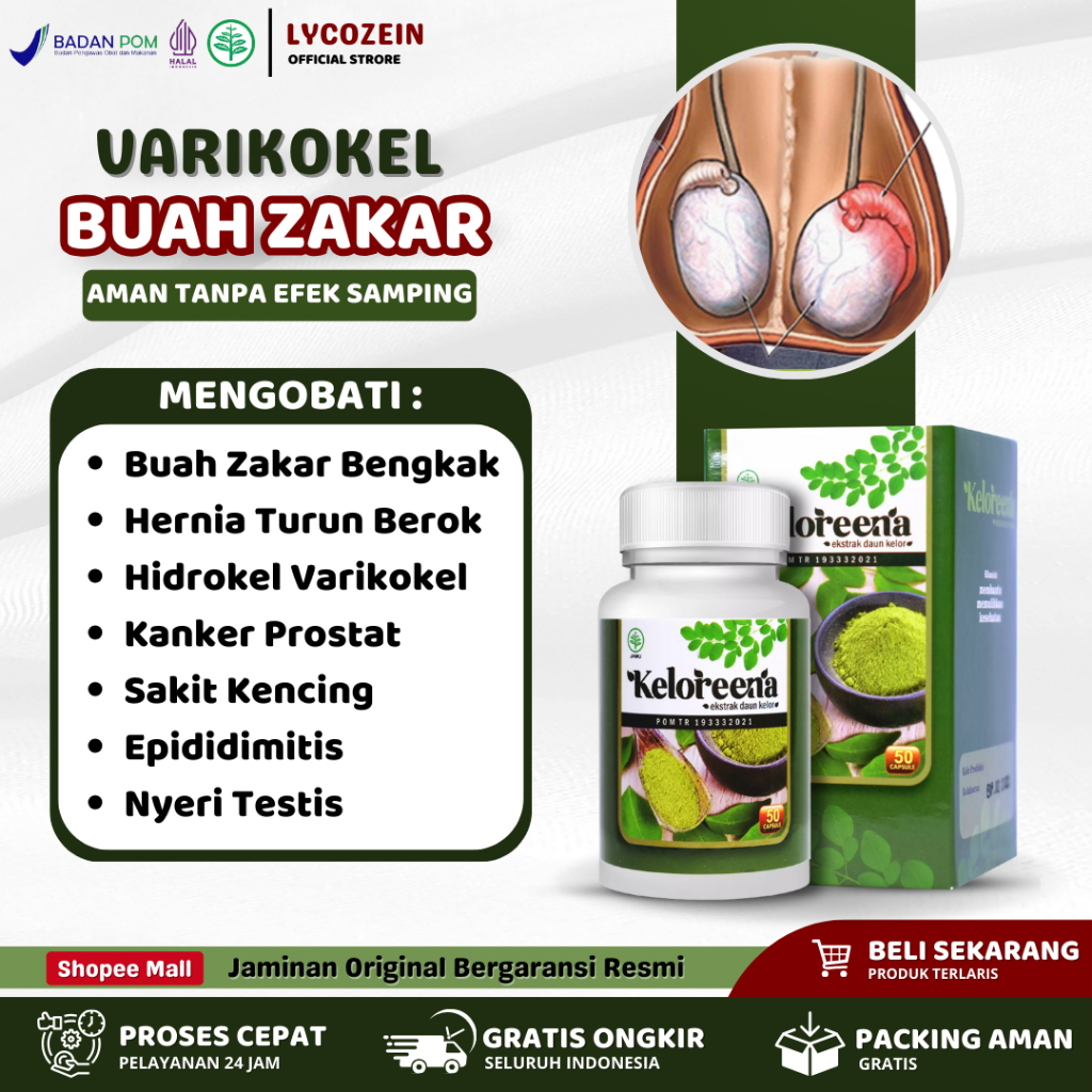 Obat Varikokel Hidrokel Buah Zakar Bengkak Sebelah Orchitis Spermatokel Infeksi Parasit - Keloreena