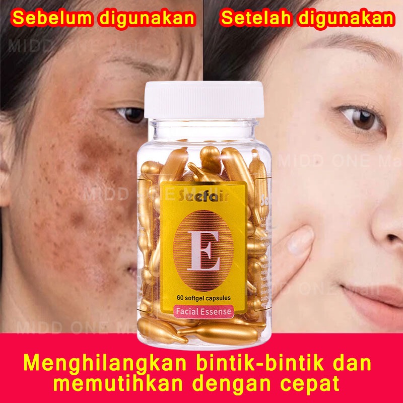 serum flek hitam membandel 60 Kapsul vitamin e menghilangkan flek hitam di wajah serum whitening ser