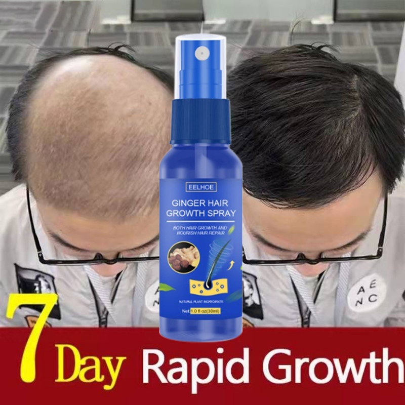 Hair Growth Spray PENUMBUH RAMBUT Cairan Serum Penumbuh Rambut Anti Rontok / Obat rambut botak / ser