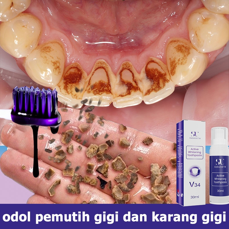 Odol pemutih gigi dan karang gigi pasta gigi pemutih pembersih karang gigi obat bau mulut 30ml
