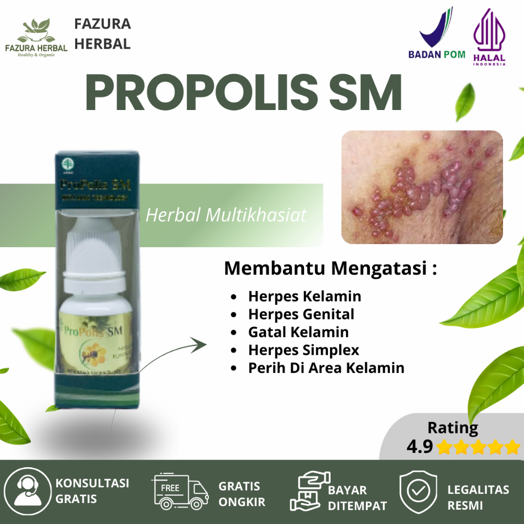 Obat Herpes Kelamin, Obat Herpes Genital, Obat Gatal Kelamin, Obat Herpes Simplex Dengan Propolis SM