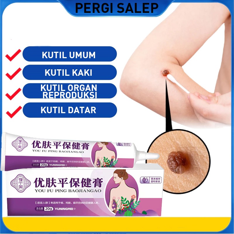 Youfuping Health Cream untuk menghilangkan mol, jagung rata dan sutra, sayuran lembut dan tidak meng