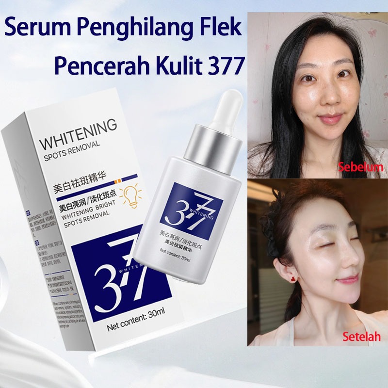 377 Memutihkan Menghilangkan Bintik Serum Memutihkan Pemudar Bintik Melembapkan Essence Wajah