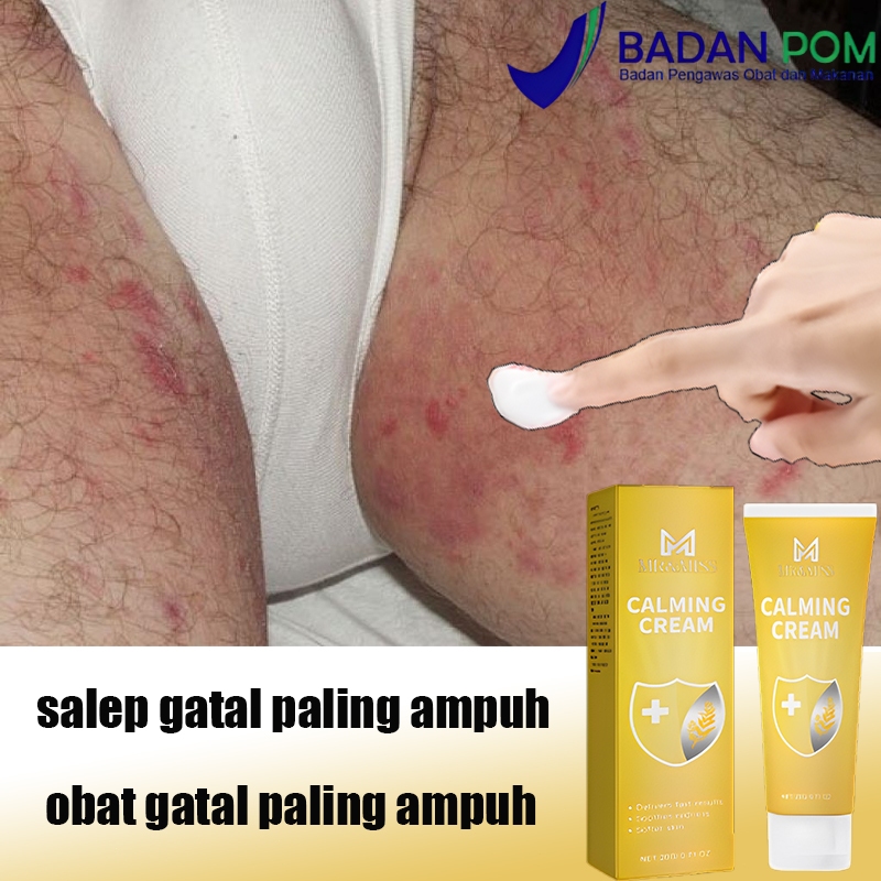 Obat gatal selangkangan Obat gatal gatal Salap gatal kulit yang ampuh Salep gatal selangkangan 20ml 