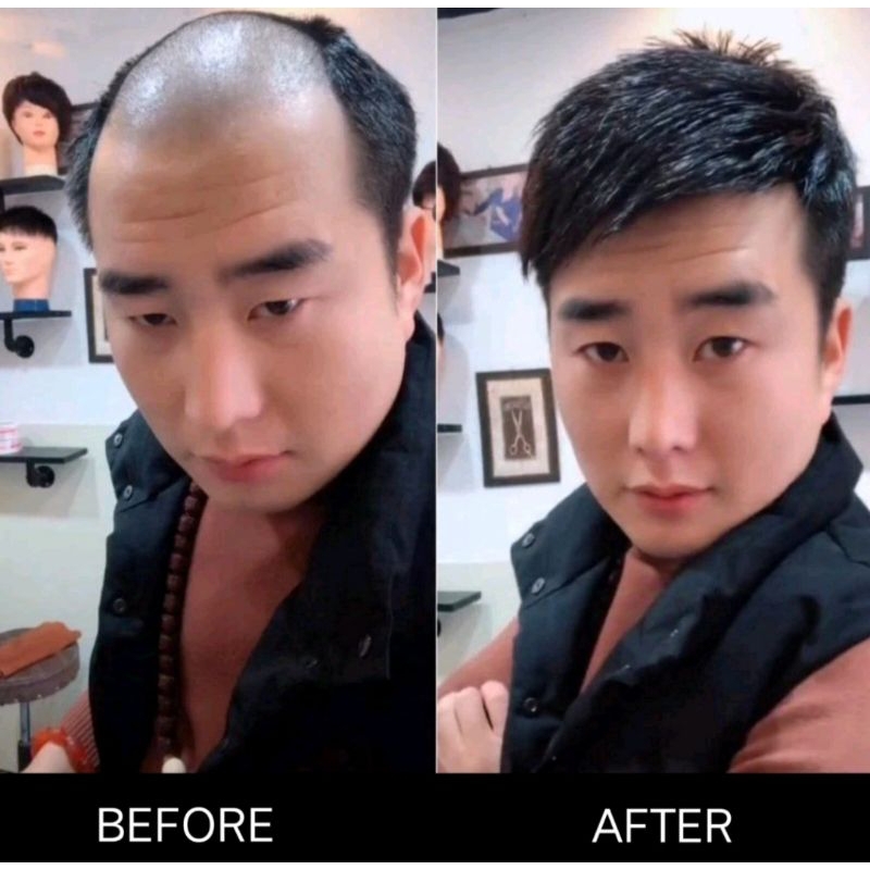 wig.toupee.wig.pria.penutup.kebotakan