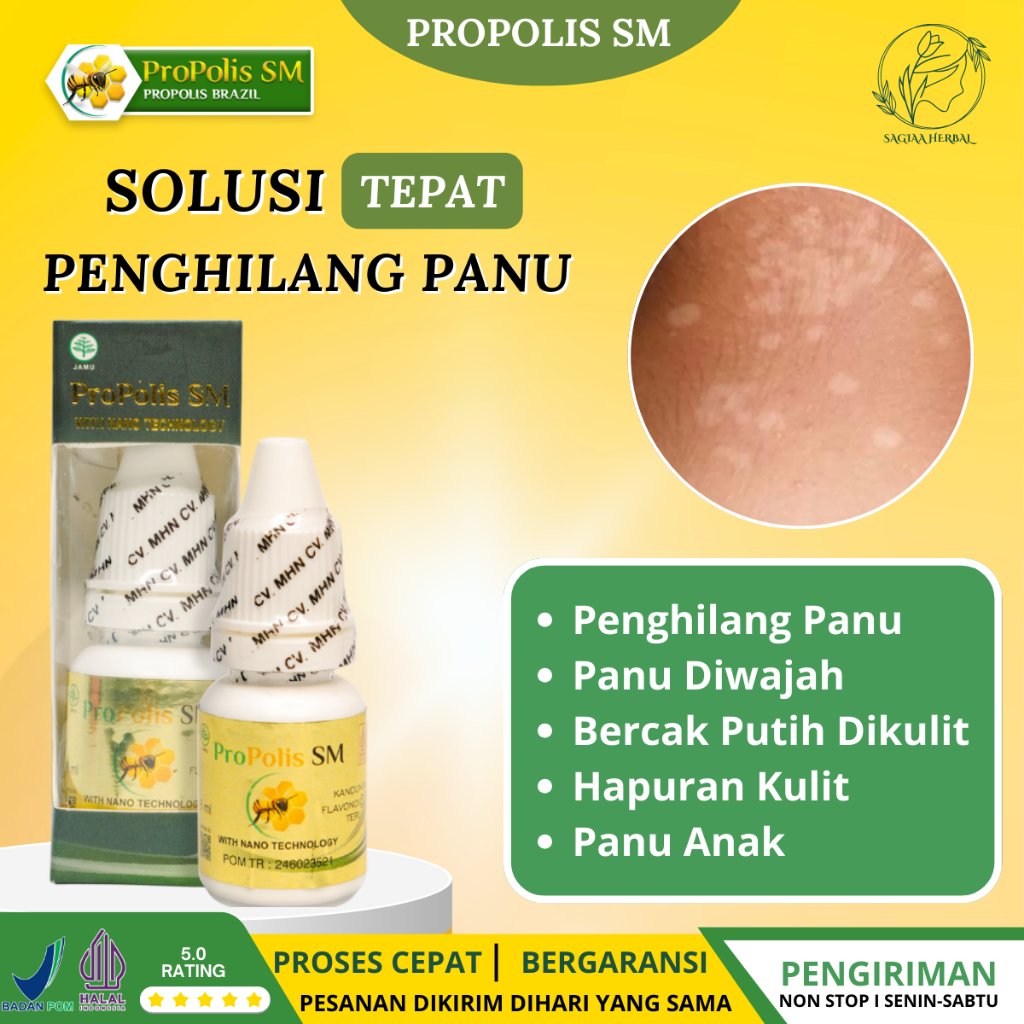 Obat Penghilang Panu Obat Panu Diwajah Obat Obat Bercak Putih Dikulit Obat Hapuran Kulit Obat Panu A