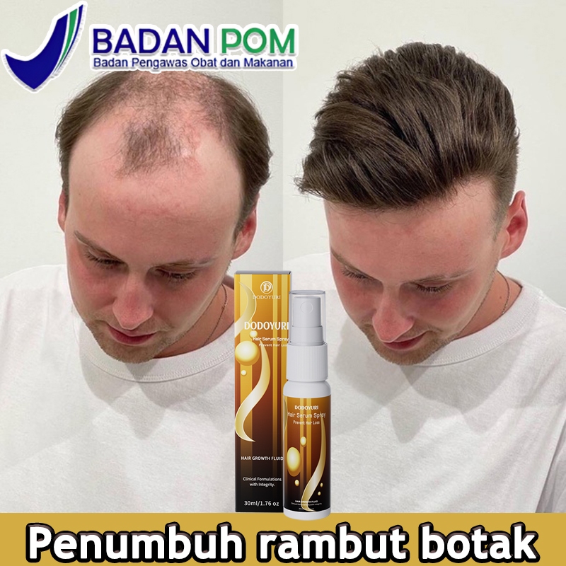 Penumbuh rambut cepat penebal rambut Penumbuh rambut botak 30ml penumbuh rambut rontok penebal rambu