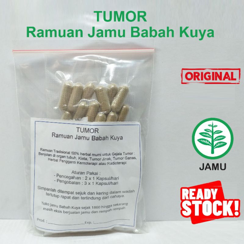 Tumor Ramuan Jamu Toko Babah Kuya Original Benjolan di organ tubuh Kista
