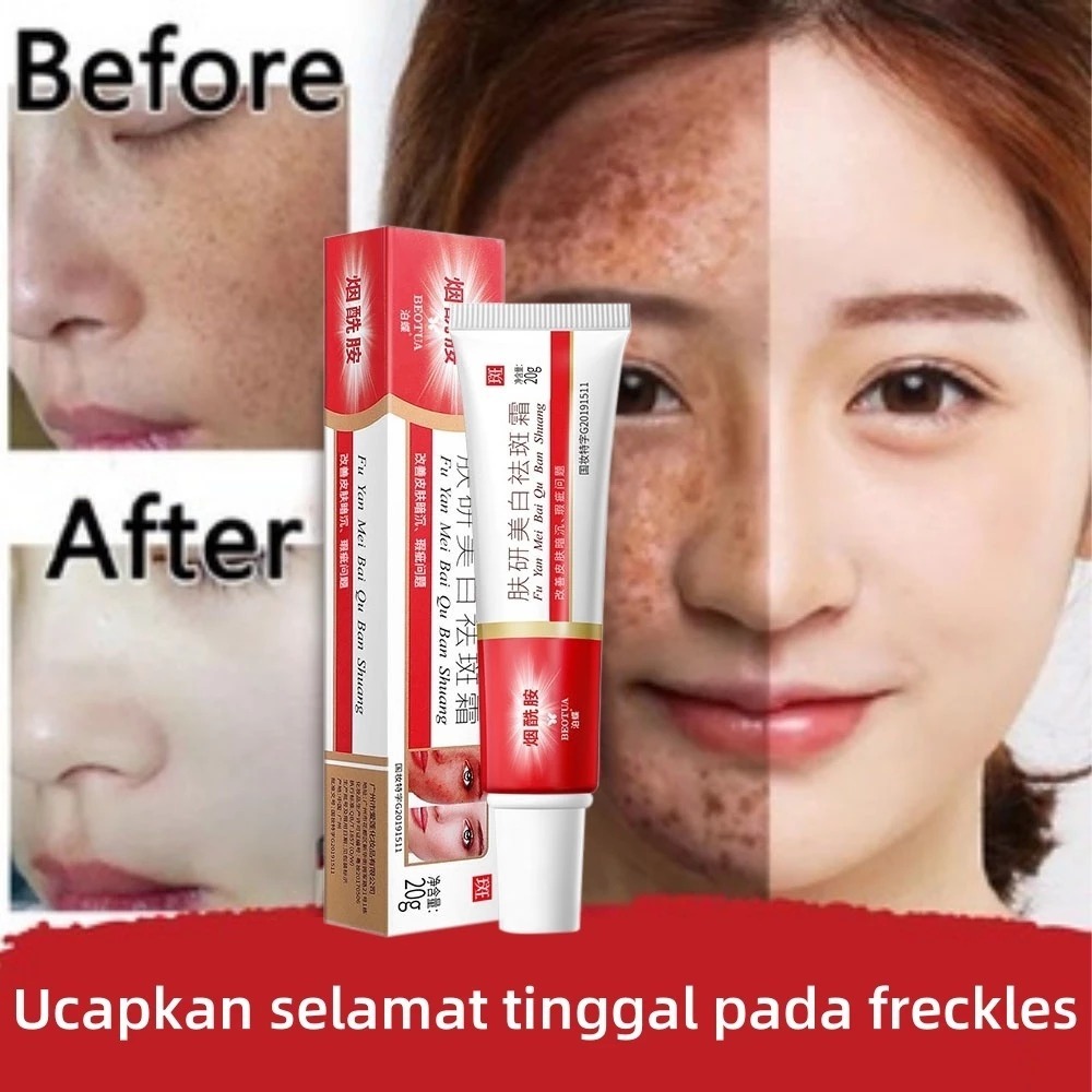 Cream Flek Hitam Melasma Membandel Krim Penghilang Flek Hitam 20g Cream Penghilang Flek Hitam