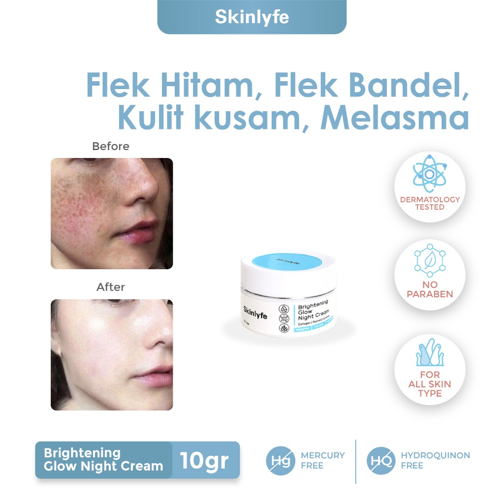 Skinlyfe Pemutih Wajah Glowing BPOM Cream Penghilang Flek Hitam Bekas Jerawat Pemutih Muka Kusam