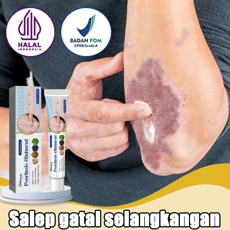 3 detik anti gatal Obat gatal selangkangan Obat psoriasis Obat Gatal-Gatal Salep gatal paling ampuh 