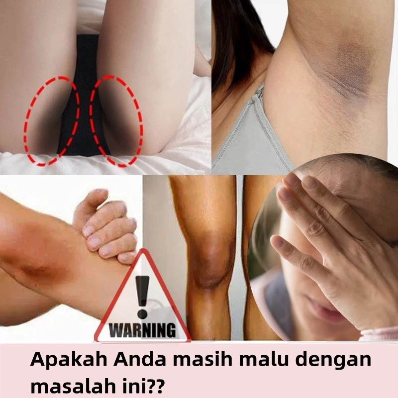 Ay00 [BPOM]Body bleaching Cream Brightening Body bleaching Pemutih badan permanen-Body