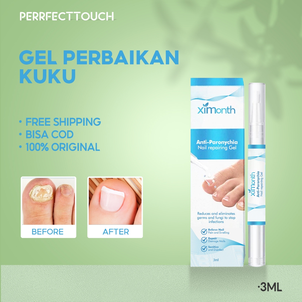 Ximonth Anti Paronychia Nail Repairing Gel Jamur Paku Merawat Hipotonitis Pereda Nyeri Kuku Jamur Ja