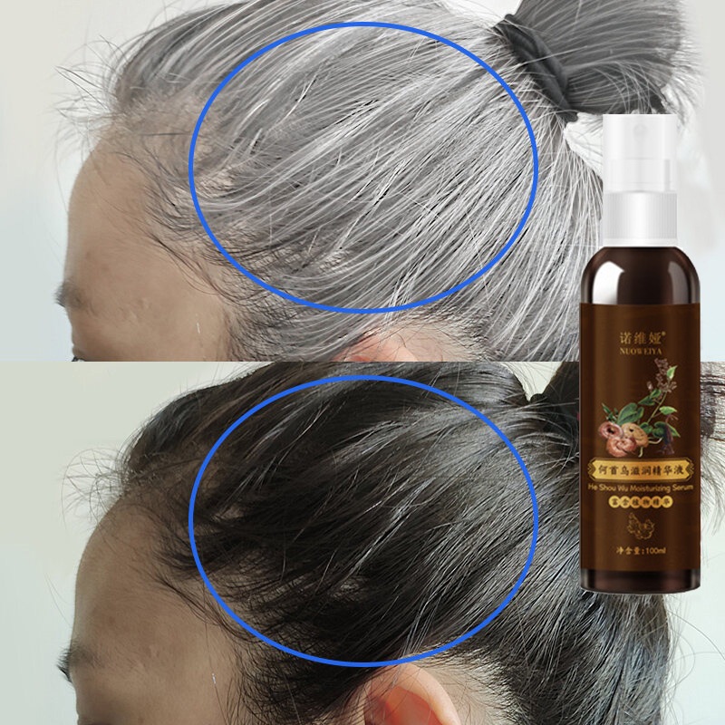 penghitam rambut uban permanen Rambut Hitam spray 100ml Polygonum Multiflorum Herbal serum Penghitam
