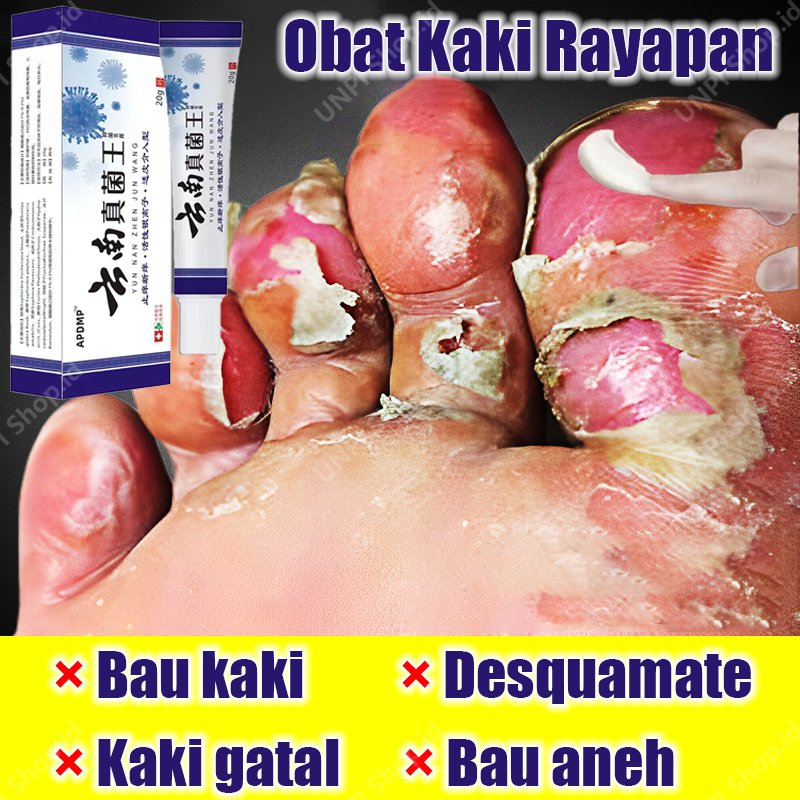 NEW Obat Kaki Rayapan Dan Bau Penghilang Bau Kaki Obat Jamur Kaki Obat Kaki Jamuran Pembersih Kulit