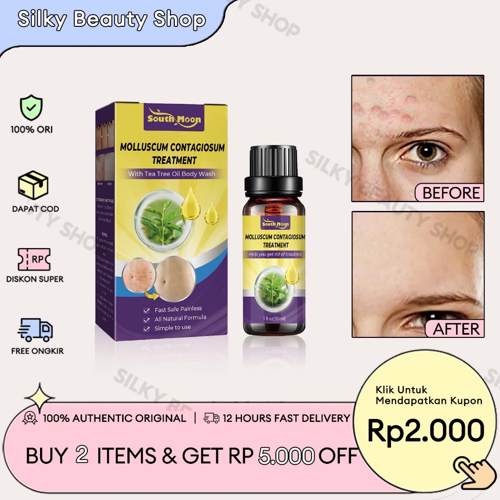 South moon Salep Penghilang Kutil 30ml Salep Khusus Penghilang Kutil Obat Obat Kutil Penghilang Kuti