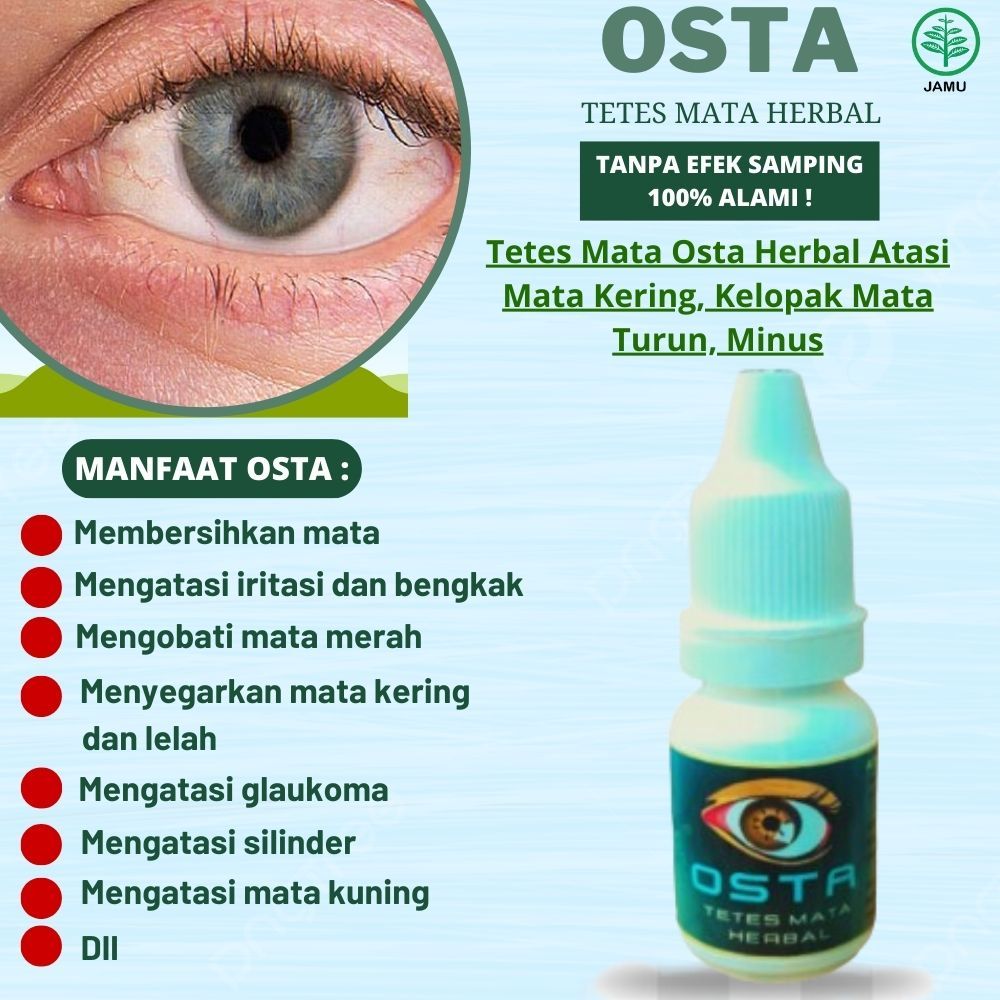 Mata Kering, Kelopak Mata Turun, Minus // Ampuh Dengan Tetes Mata Herbal OSTA
