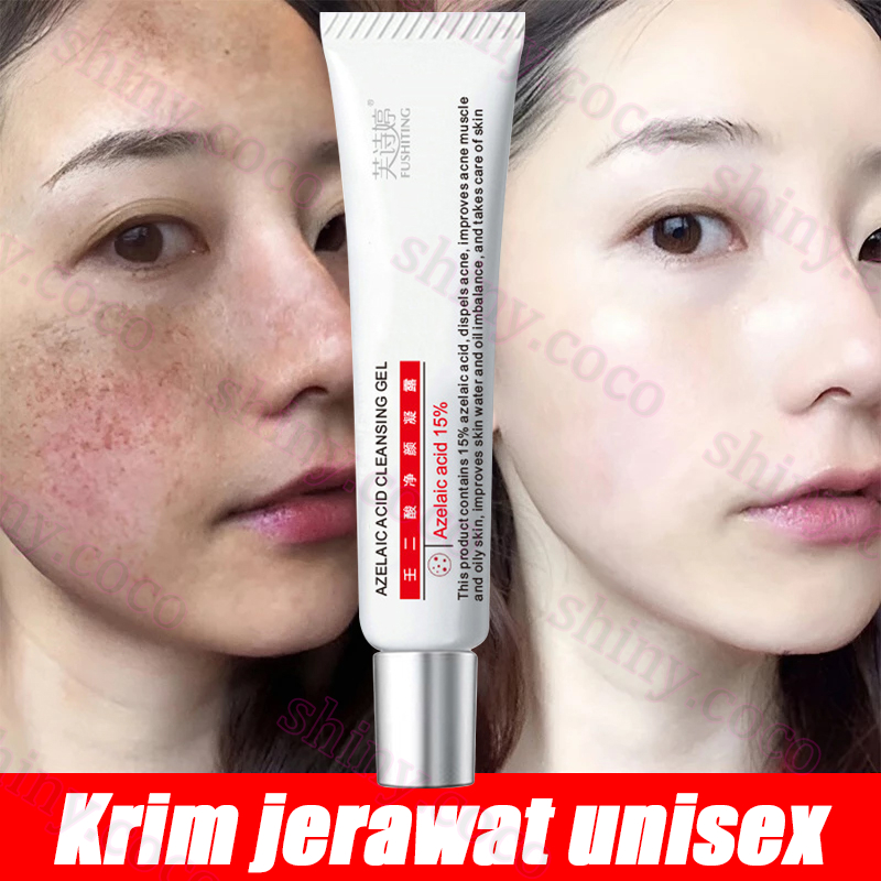 Penghilang jerawat obat jerawat dan bekas jerawat penghilang bekas jerawat 15g Obat jerawat Salep Pe