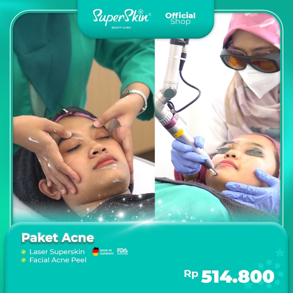 Superskin Paket Acne: Facial Acne Peel, Laser Superskin