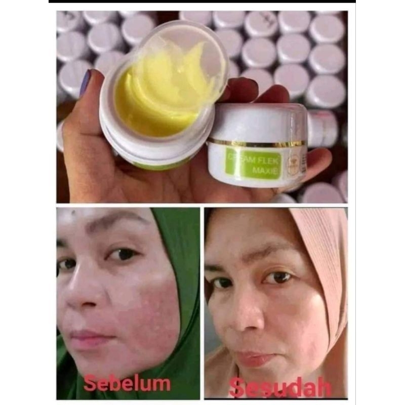 MAXIE CREAM FLEK NIGH CREAM BPOM AMPUH / SKINCARE BRITENING MEMUDARKAN FLEK HITAM DAN MEMBUAT GLOWIN