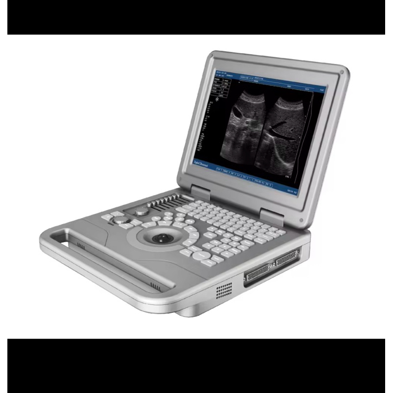 USG 2DIMENSI L8 Notebook LCD Digital Ultrasound Scanner